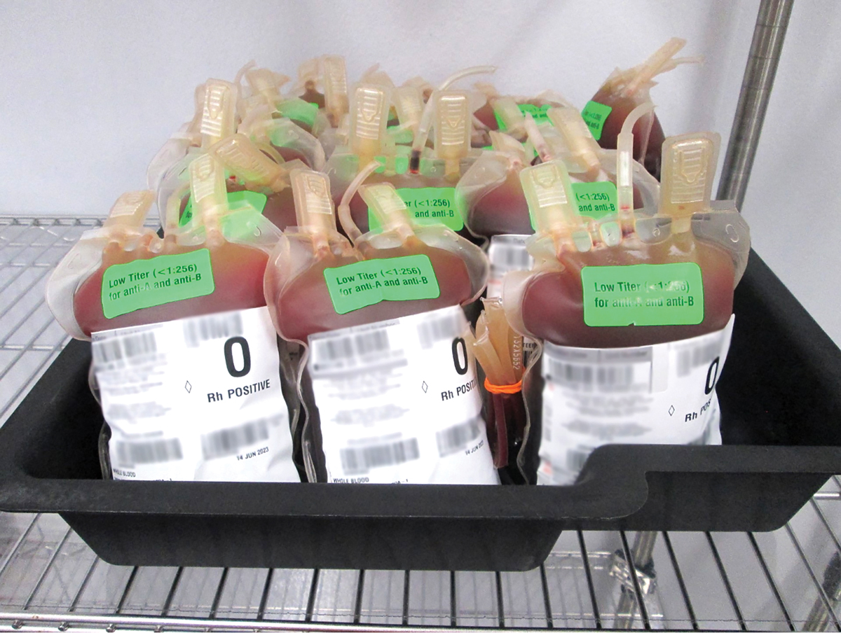 Low-titer O whole blood is stored at the Fort Leonard Wood Blood Donor Center 22 June 2023 for the Armed Services Blood Program. This lifesaving blood product can be transfused into patients of any blood type, making it a valuable tool for the military, which often needs to transfuse blood in austere environments