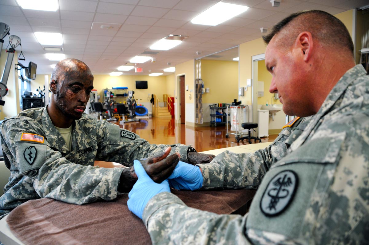 Staff Sgt. Mike Calaway, the NCO in charge of outpatient burn rehabilitation, gently stretches the scarred skin on Pfc. Antoine Reeves’ hands to reduce stiffness and increase his range of motion.