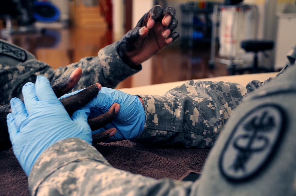 Staff Sgt. Mike Calaway, the NCO in charge of outpatient burn rehabilitation, gently stretches the scarred skin on Pfc. Antoine Reeves’ hands to reduce stiffness and increase his range of motion. 